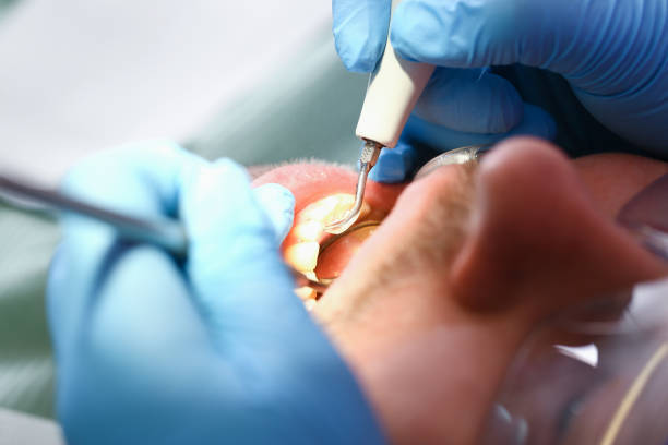 Best Emergency Treatment for Toothache in Abita Springs, LA